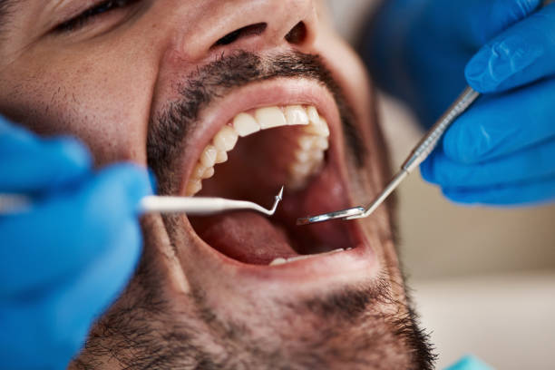 Best Emergency Treatment for Jaw Pain or Injury in Rancho Laveras, CA