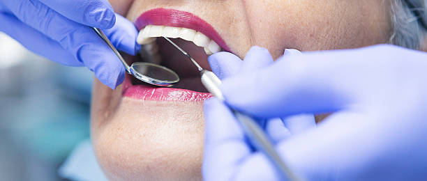 Best Broken or Chipped Tooth Repair in Rancho Laveras, CA